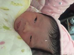 高龄刘女士成功助孕