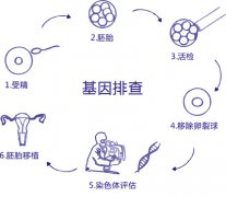 性别筛选-胎儿性别鉴定
