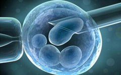 如何治疗多囊卵巢综合症